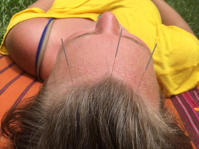 Alternative Healing Website Acupuncture