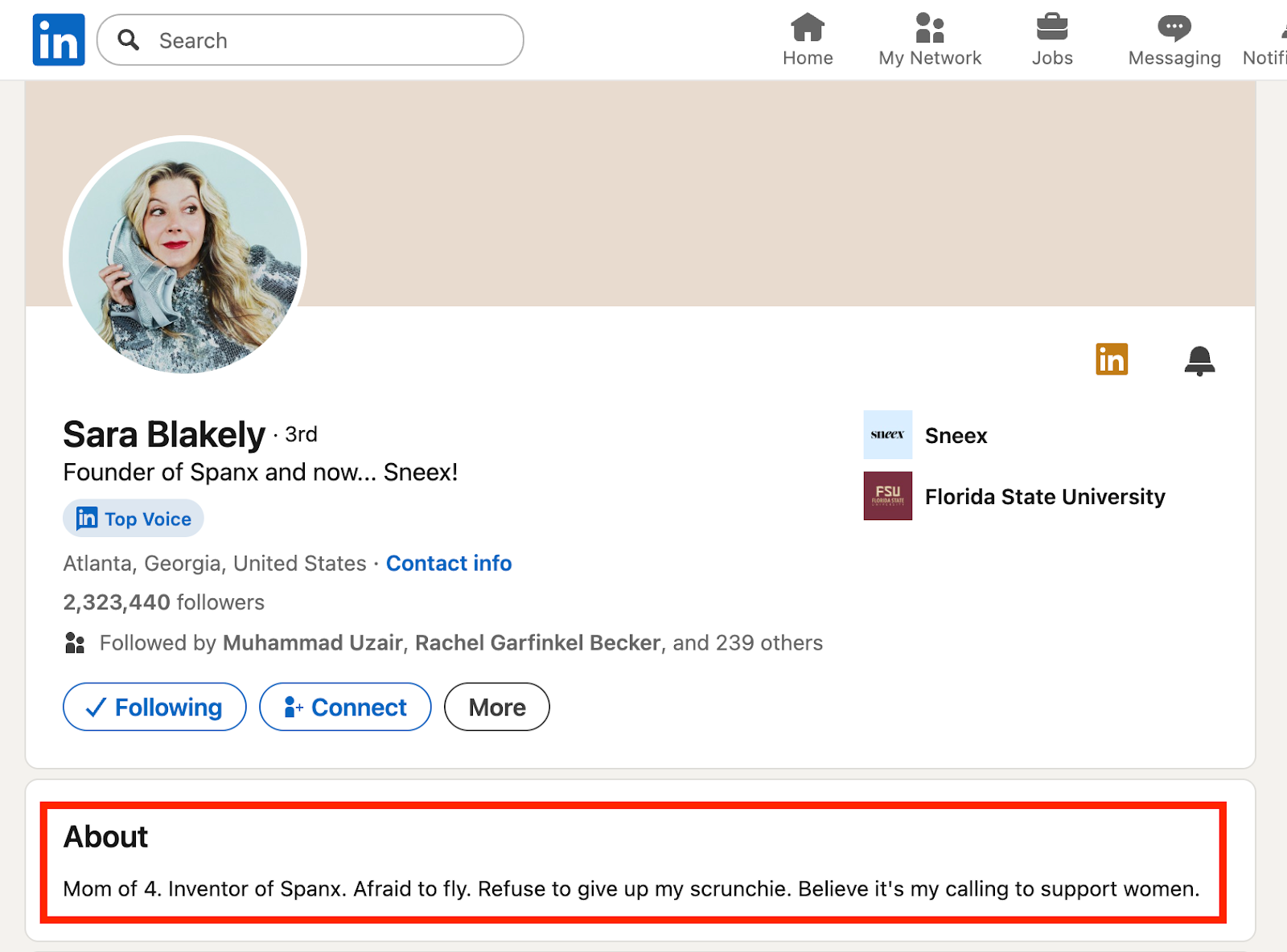 screenshot of a LinkedIn profile page showing the About section