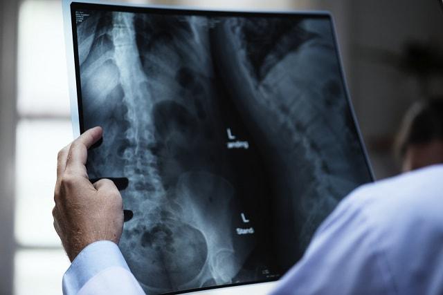 Insurance Options Xray